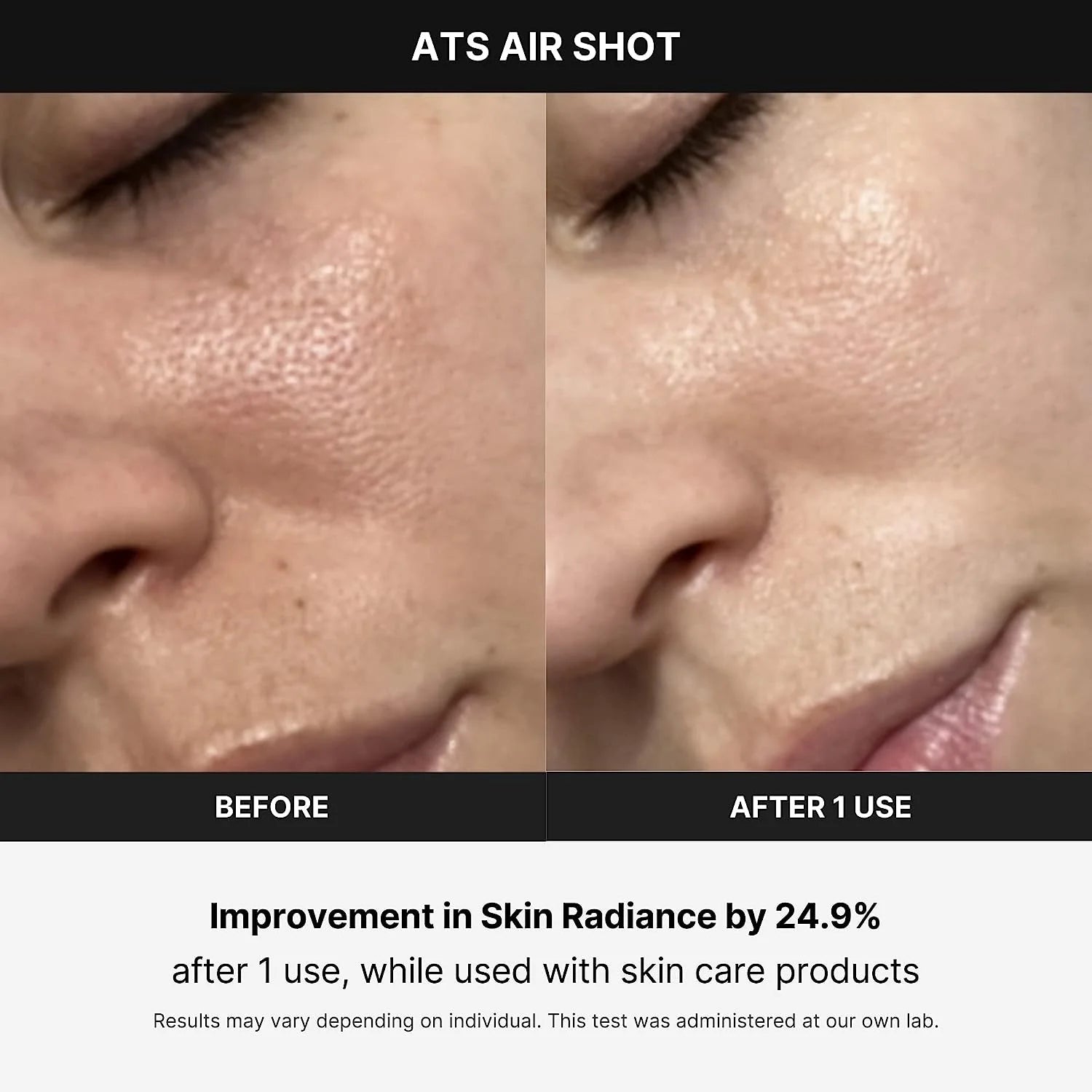 MEDICUBE - SKIN CARE DEVICES