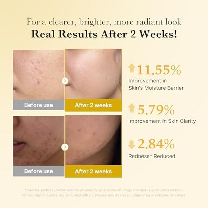 Kojic Acid Renew & Smooth Duo for Troubled Skin: Kojic Acid Turmeric Clarifying Toner Pad and Kojic Acid Turmeric Clarifying & Balancing Capsule Serum