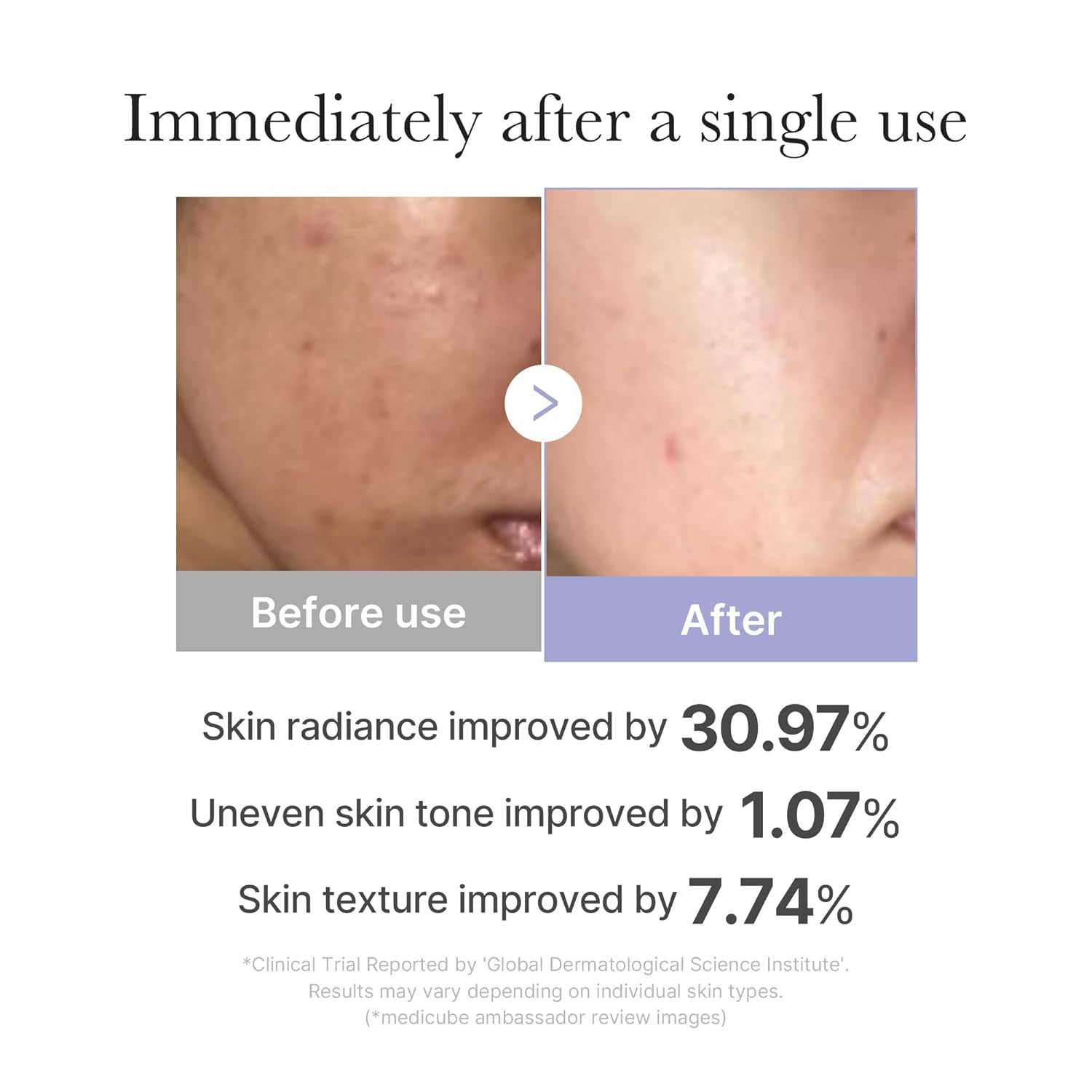 MEDICUBE - Mini Booster Pro White | Affordable At-Home Facial Device for Beginners - Portable Glow Booster for Glass Skin, Boosting Skin Care Absorption, Skincare for Teens, Korean Skin Care
