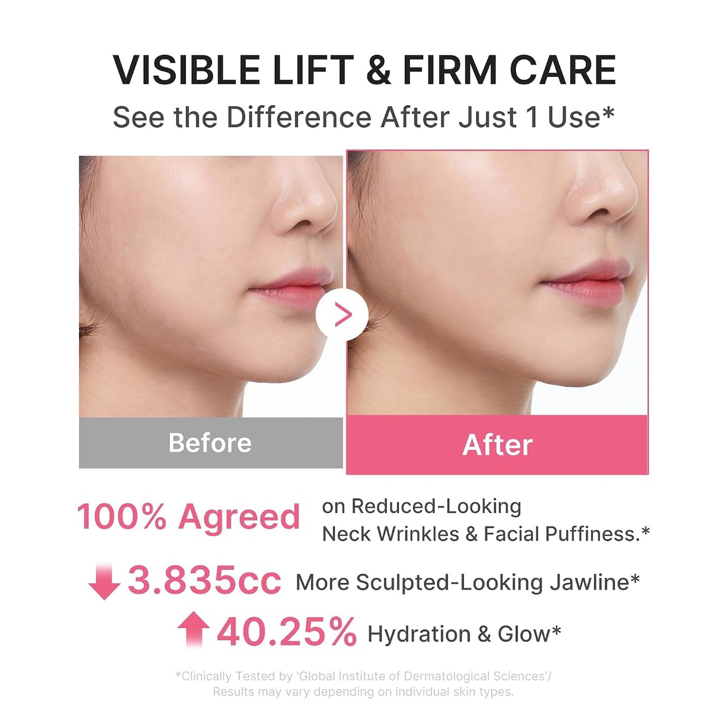 MEDICUBE - PDRN Collagen Gua Sha Neck Wrinkle Cream | Built-In Gua Sha Massager with Volufiline 5% | Firming, Contour Care for the Look of Fine Lines, Jawline, Neck, Décolleté | Korean Skincare, 3.17 Oz