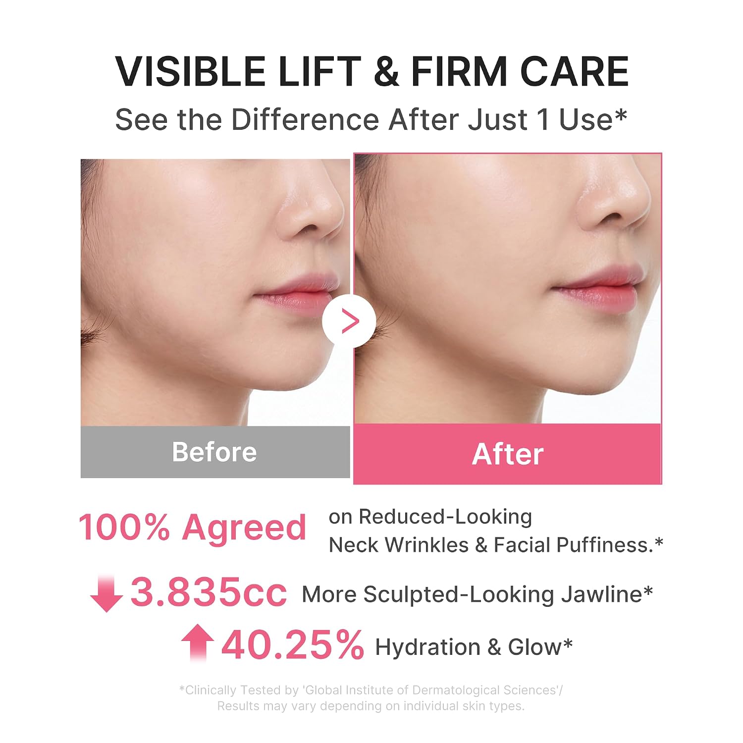 MEDICUBE - PDRN Collagen Gua Sha Neck Wrinkle Cream | Built-In Gua Sha Massager with Volufiline 5% | Firming, Contour Care for the Look of Fine Lines, Jawline, Neck, Décolleté | Korean Skincare, 3.17 Oz