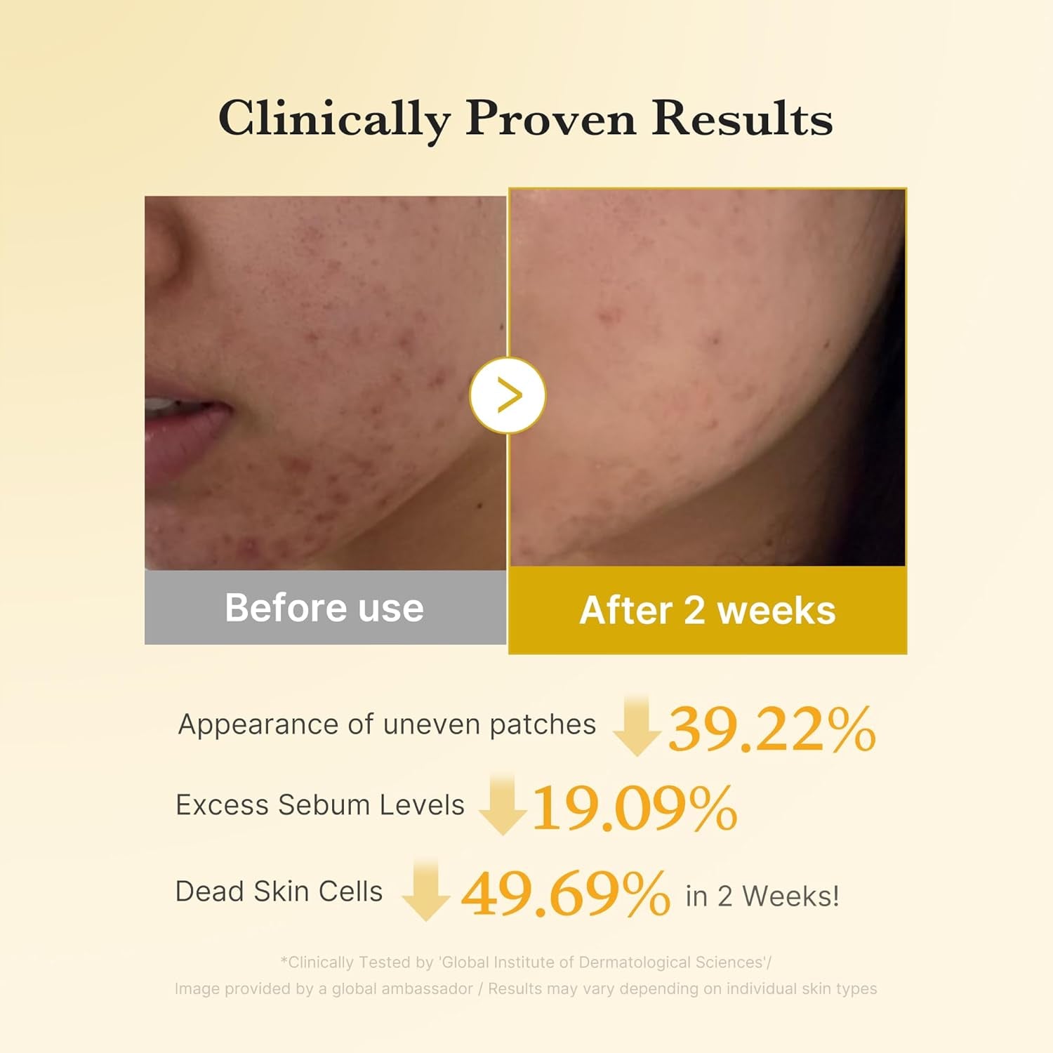 Kojic Acid Renew & Smooth Duo for Troubled Skin: Kojic Acid Turmeric Clarifying Toner Pad and Kojic Acid Turmeric Clarifying & Balancing Capsule Serum