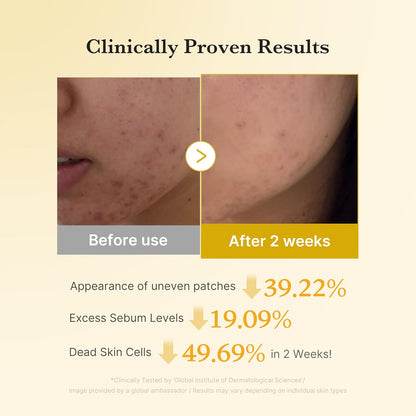 Kojic Acid Renew & Smooth Duo for Troubled Skin: Kojic Acid Turmeric Clarifying Toner Pad and Kojic Acid Turmeric Clarifying & Balancing Capsule Serum