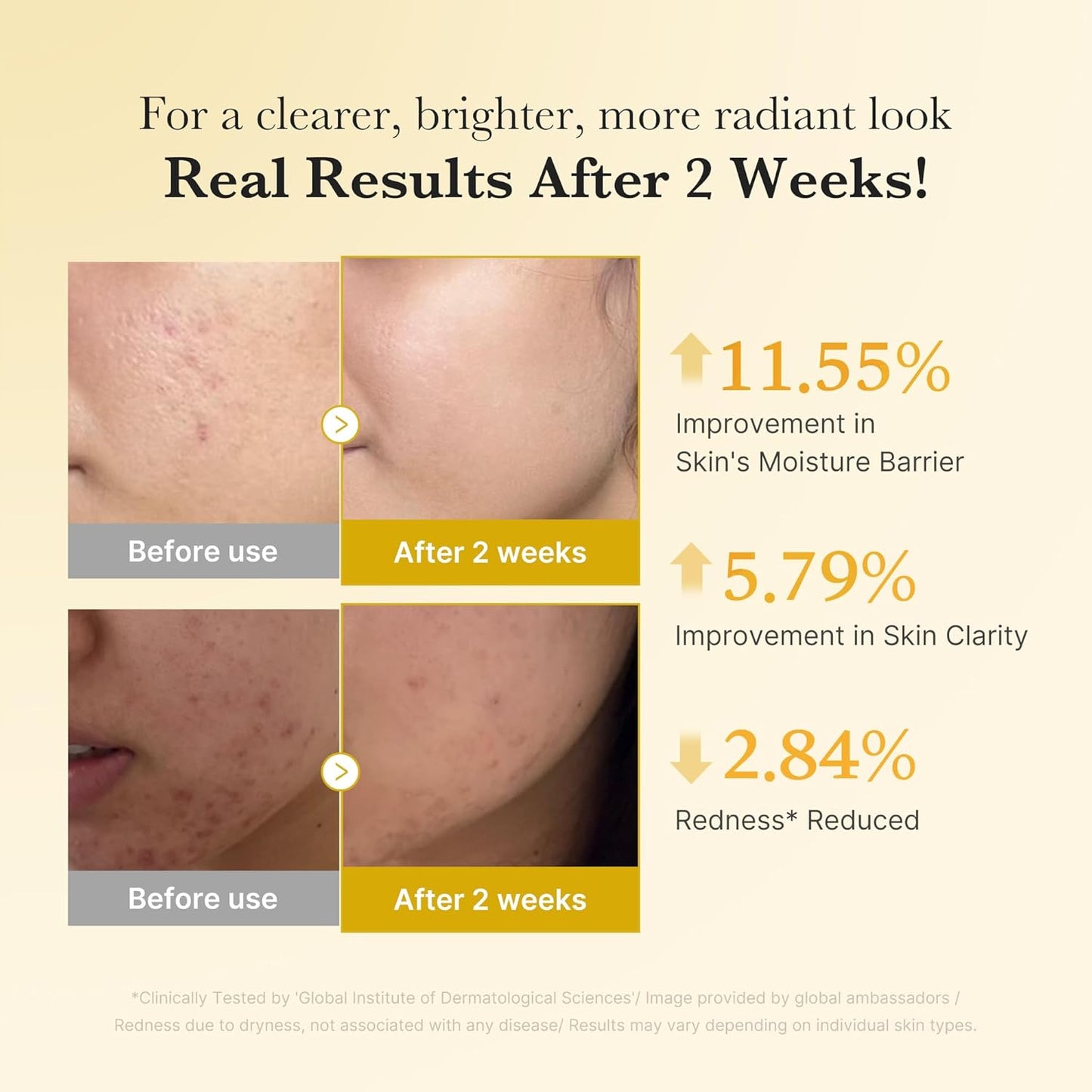 MEDICUBE - Kojic Acid Turmeric Clarifying & Balancing Capsule Serum for Troubled Skin | Soothing & Brightening Facial Serum | Niacinamide & Glow Capsules for Hydration and Barrier Support | 1.01 Fl.Oz