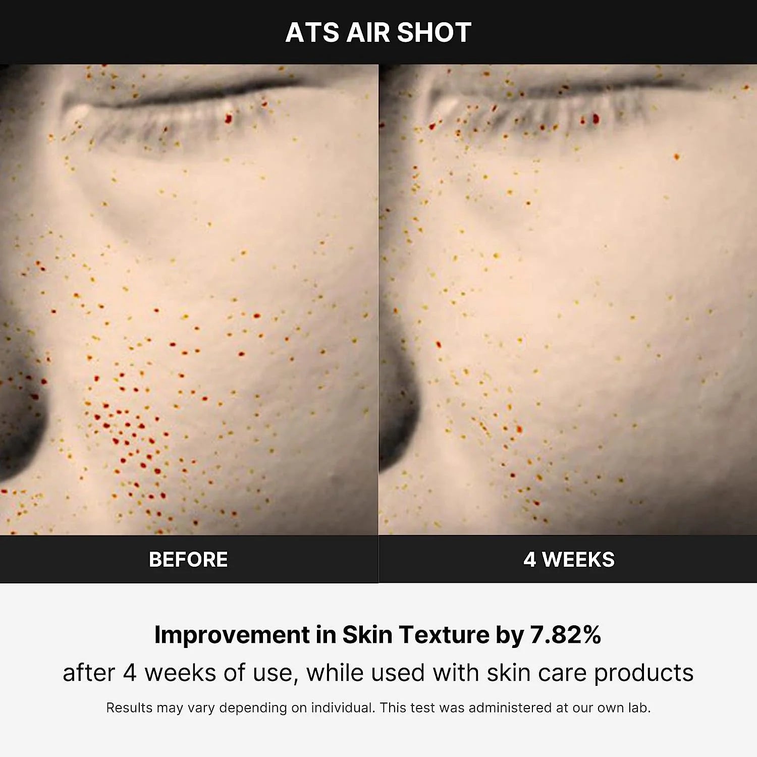 MEDICUBE - SKIN CARE DEVICES
