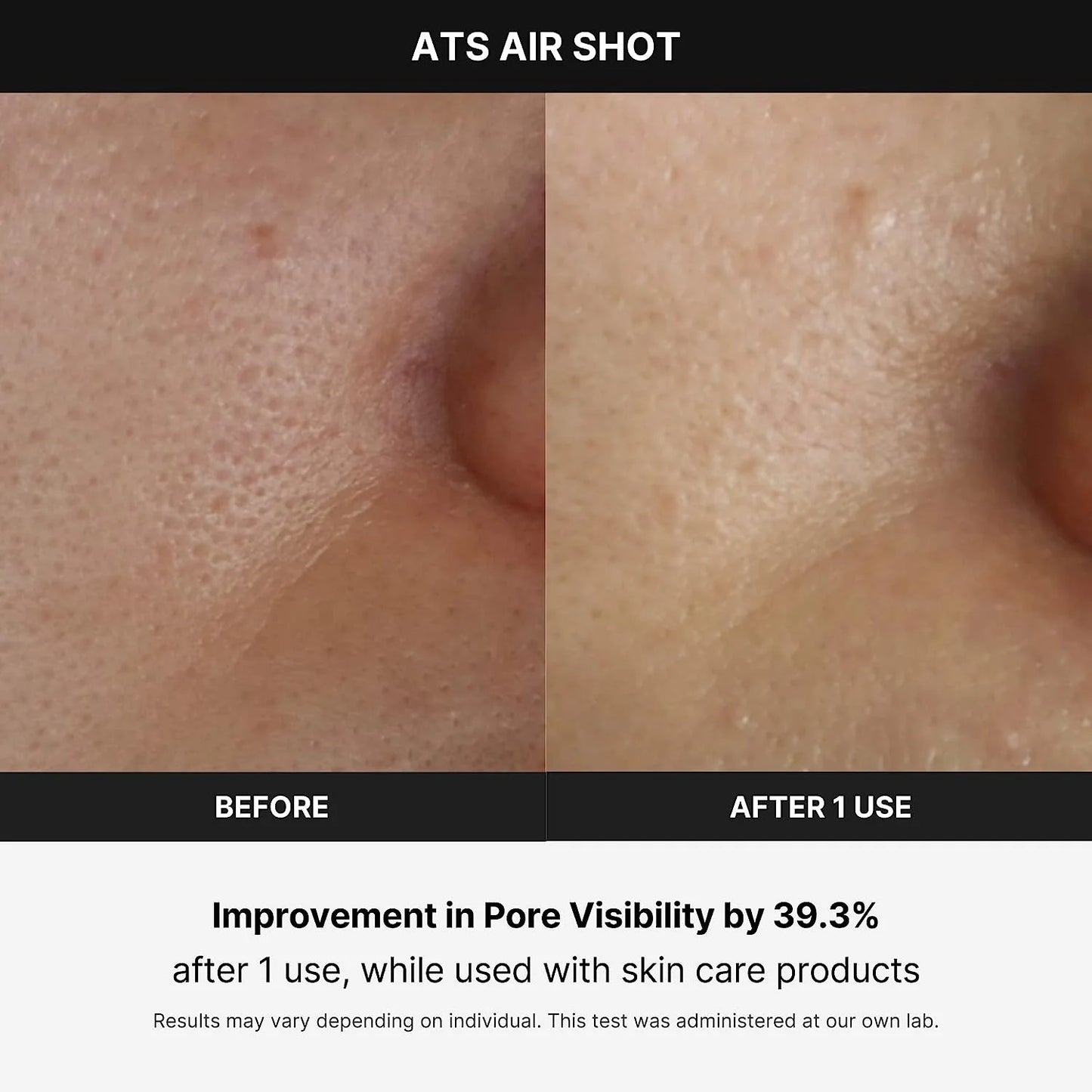 MEDICUBE - SKIN CARE DEVICES